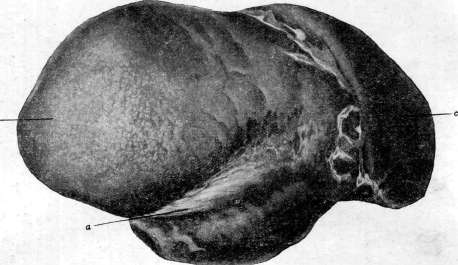 Liver: figure 1 from the 1928–1936 encyclopedia article