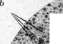 Liver: figure 3 from the 1928–1936 encyclopedia article