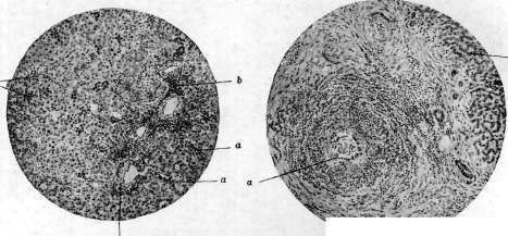 Liver: figure 29 from the 1928–1936 encyclopedia article
