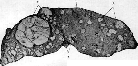 Liver: figure 30 from the 1928–1936 encyclopedia article
