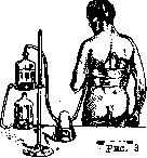 Pleurisy: figure 7 from the 1928–1936 encyclopedia article