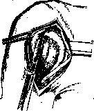 Shoulder Joint: figure 8 from the 1928–1936 encyclopedia article