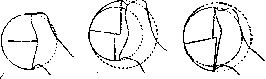 Shoulder Joint: figure 2 from the 1928–1936 encyclopedia article
