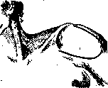 Shoulder Joint: figure 11 from the 1928–1936 encyclopedia article