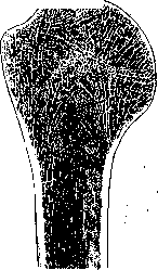 Arm (Humerus): figure 2 from the 1928–1936 encyclopedia article
