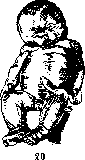 Fetus: figure 15 from the 1928–1936 encyclopedia article