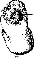 Fetus: figure 21 from the 1928–1936 encyclopedia article