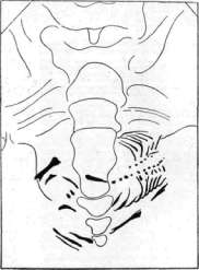 Fetus: figure 9 from the 1928–1936 encyclopedia article