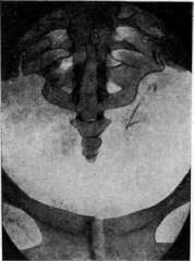 Fetus: figure 6 from the 1928–1936 encyclopedia article
