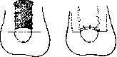 Penis: figure 15 from the 1928–1936 encyclopedia article