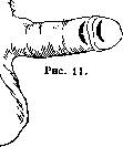 Penis: figure 9 from the 1928–1936 encyclopedia article