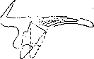 Progenia, Prognathia: figure 4 from the 1928–1936 encyclopedia article