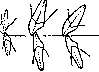 Progenia, Prognathia: figure 1 from the 1928–1936 encyclopedia article