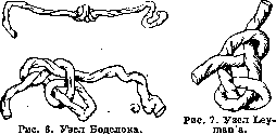 Umbilical Cord: figure 5 from the 1928–1936 encyclopedia article