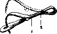 Umbilical Cord: figure 11 from the 1928–1936 encyclopedia article