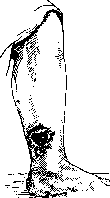 Neurotomy: figure 4 from the 1928–1936 encyclopedia article