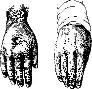 Neurotomy: figure 2 from the 1928–1936 encyclopedia article