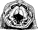 Necatoriasis: figure 1 from the 1928–1936 encyclopedia article