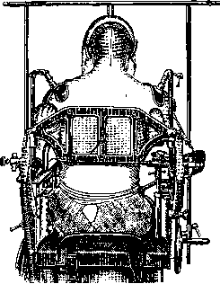 Operating Tables: figure 7 from the 1928–1936 encyclopedia article