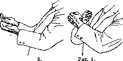 Otolithic Apparatus: figure 3 from the 1928–1936 encyclopedia article