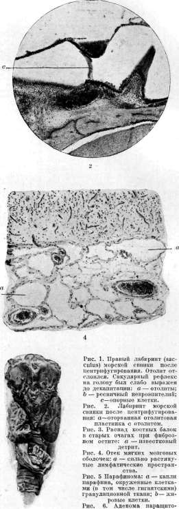 Otolithic Apparatus: figure 7 from the 1928–1936 encyclopedia article