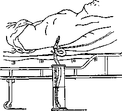 Aspirators: figure 2 from the 1928–1936 encyclopedia article