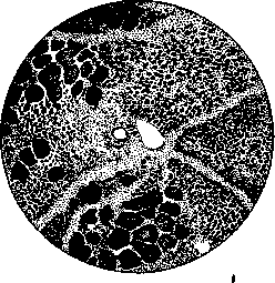 Atrophy: figure 2 from the 1928–1936 encyclopedia article