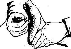 Babinski Reflex: figure 1 from the 1928–1936 encyclopedia article