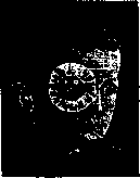 Blennorrhea: figure 2 from the 1928–1936 encyclopedia article