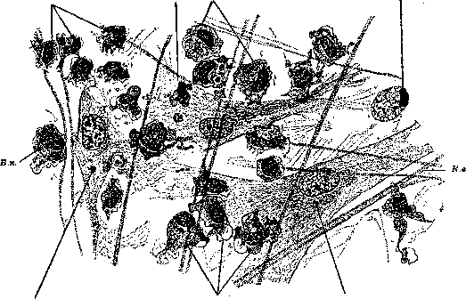 Wandering Cells: figure 2 from the 1928–1936 encyclopedia article