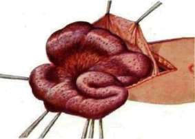 Peritoneum: figure 2 from the 1928–1936 encyclopedia article