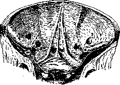 Abdominal Wall: figure 6 from the 1928–1936 encyclopedia article