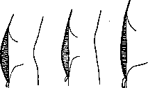 Abdominal Wall: figure 3 from the 1928–1936 encyclopedia article
