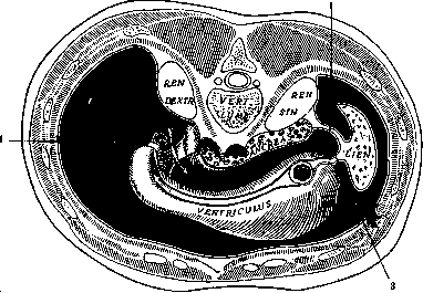 Abdominal Wall: figure 1 from the 1928–1936 encyclopedia article