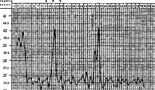 Relapsing Fever: figure 8 from the 1928–1936 encyclopedia article