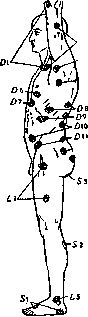 Head's Zones: figure 1 from the 1928–1936 encyclopedia article