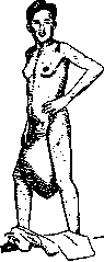Gynecomastia: figure 2 from the 1928–1936 encyclopedia article