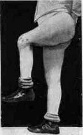 Josef Hyrtl: figure 6 from the 1928–1936 encyclopedia article