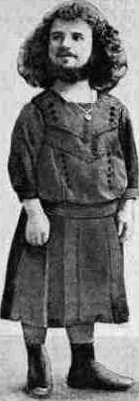 Josef Hyrtl: figure 2 from the 1928–1936 encyclopedia article