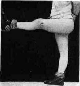 Josef Hyrtl: figure 5 from the 1928–1936 encyclopedia article