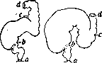 Hirschsprung Disease: figure 5 from the 1928–1936 encyclopedia article