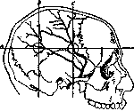 Brain (551 General diagnostics of brain diseases): figure 43 from the 1928–1936 encyclopedia article