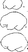 Brain (551 General diagnostics of brain diseases): figure 10 from the 1928–1936 encyclopedia article