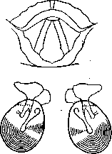 Graphical Representations (GRAPHICAL REPRESENTATIONS): figure 5 from the 1928–1936 encyclopedia article