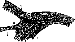Hypermetropia: figure 1 from the 1928–1936 encyclopedia article