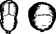 Dolichocephaly: figure 2 from the 1928–1936 encyclopedia article