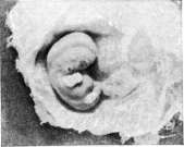 Embryo: figure 16 from the 1928–1936 encyclopedia article