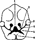 Harelip: figure 1 from the 1928–1936 encyclopedia article