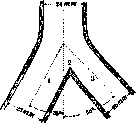 Foreign Bodies: figure 5 from the 1928–1936 encyclopedia article