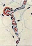 Capillaroscopy: figure 2 from the 1928–1936 encyclopedia article